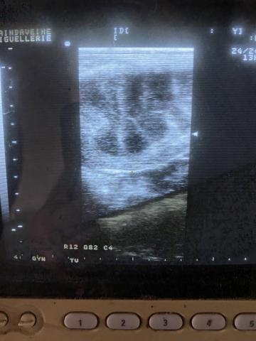 Utérus normal de jument en début d'oestrus